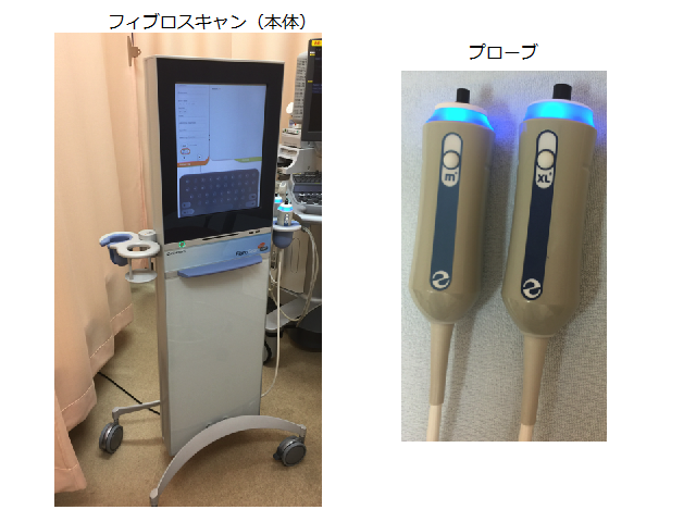 フィブロスキャンとプローブ